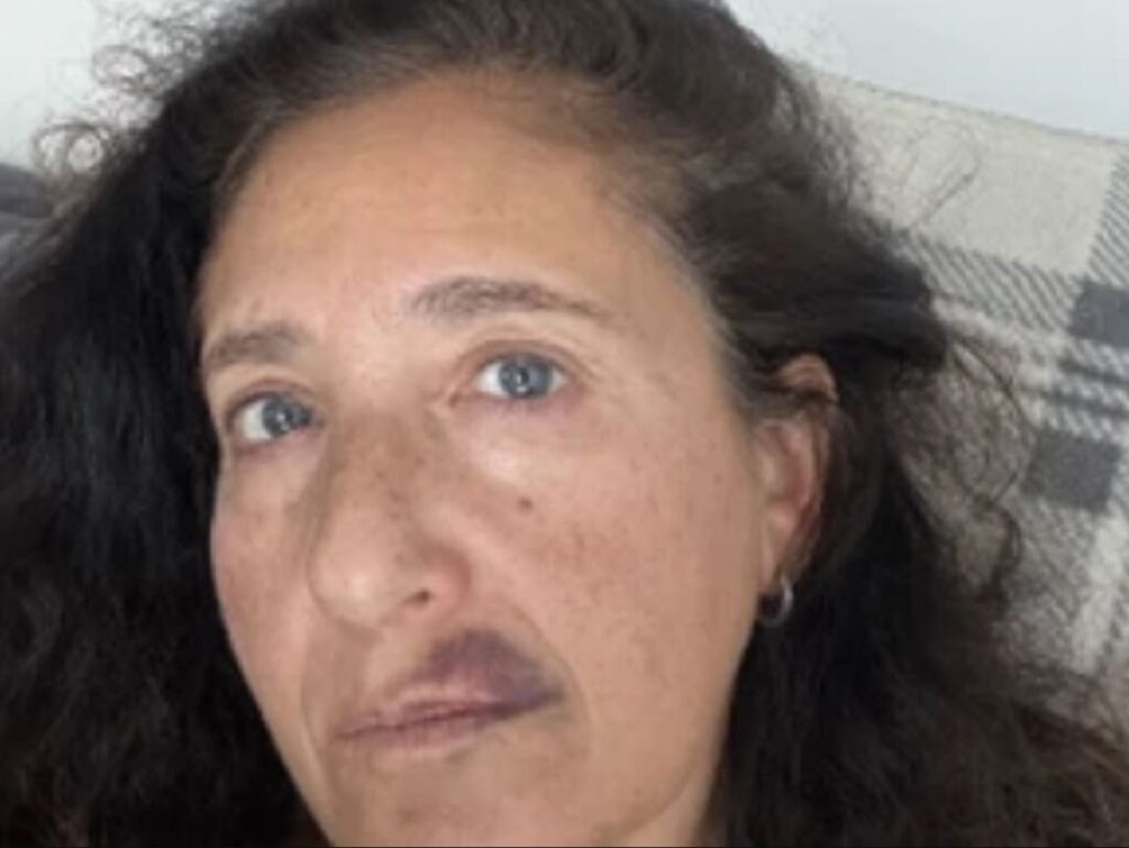Who is Olga Goldberg? a Jewish lady was attacked in a Toronto anti-Semitic incident